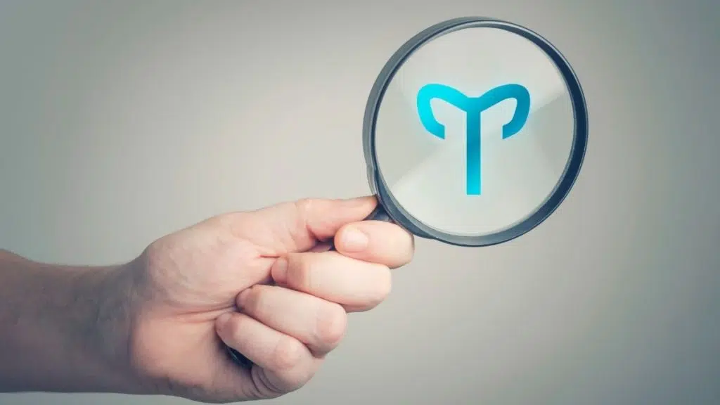 koc erkegi ozellikler8794